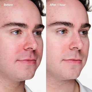 Clinique Acne Solutions Clinical Advanced Clearing Gel - Clear